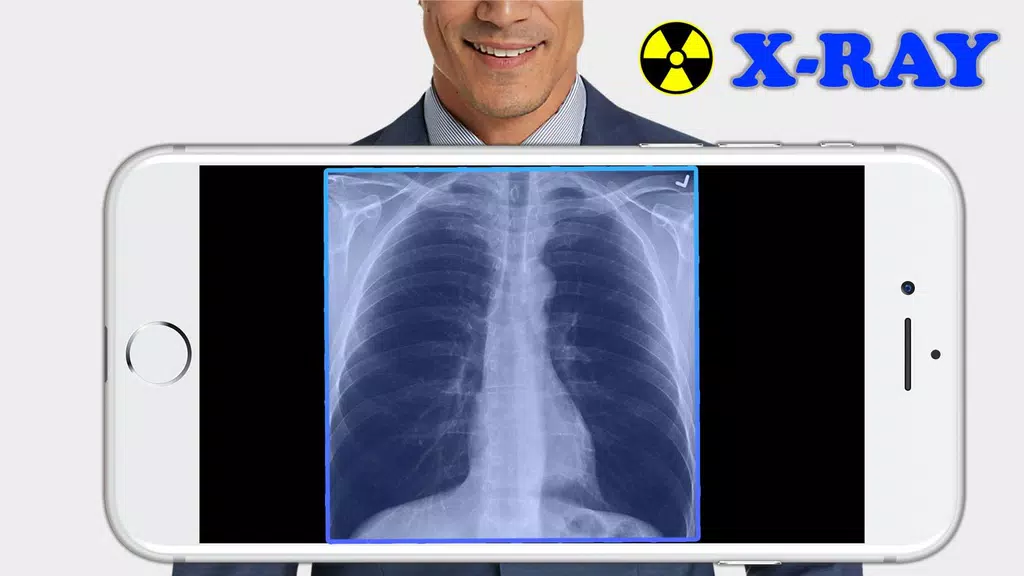 X-Ray Filter Photo Screenshot 1