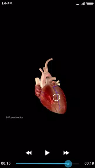 Cardiology-Animated Dictionary Captura de tela 3