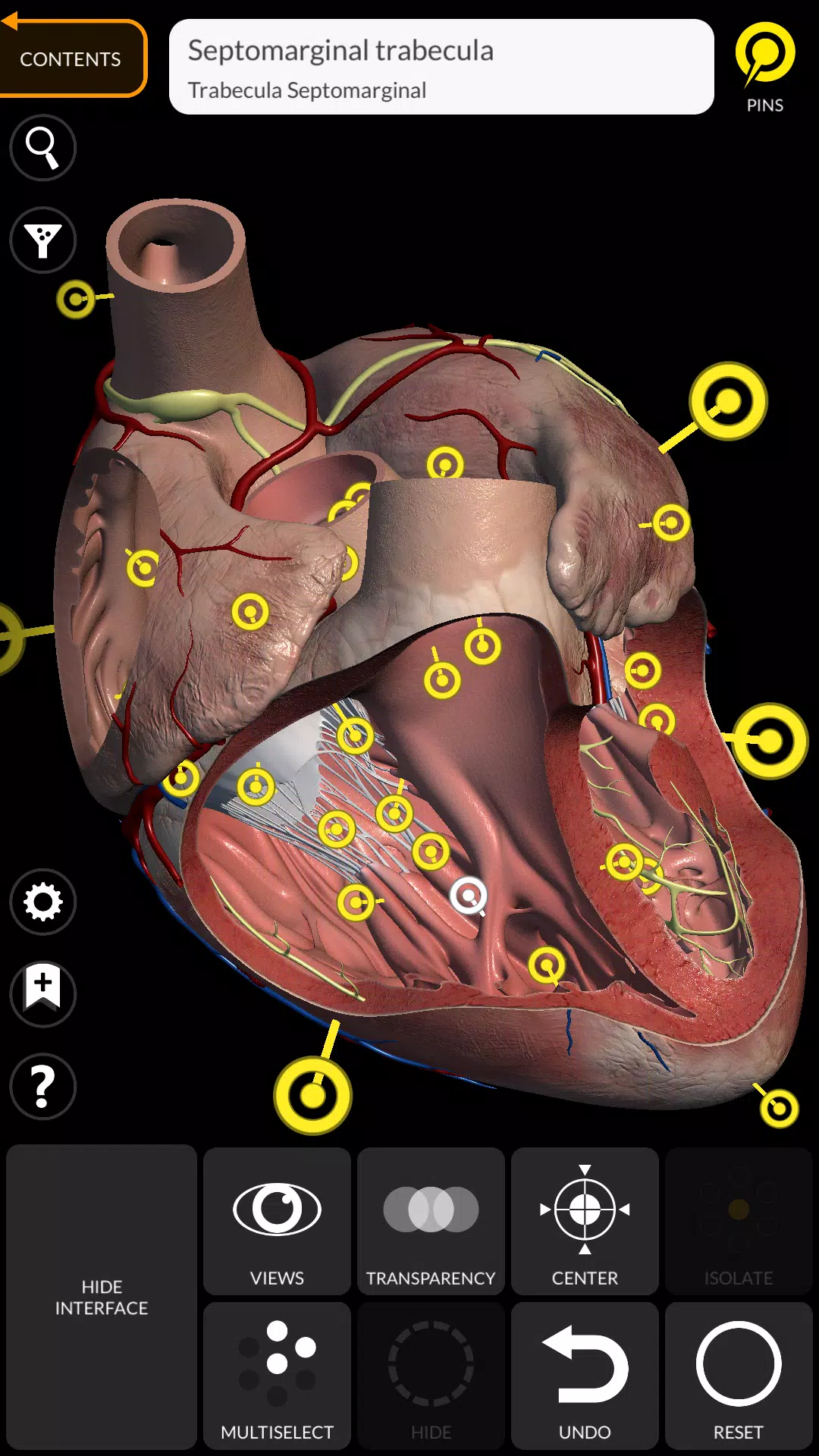 Anatomy 3D Atlas Captura de tela 3