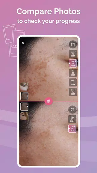 FeelinMySkin: Skincare Routine Screenshot 3