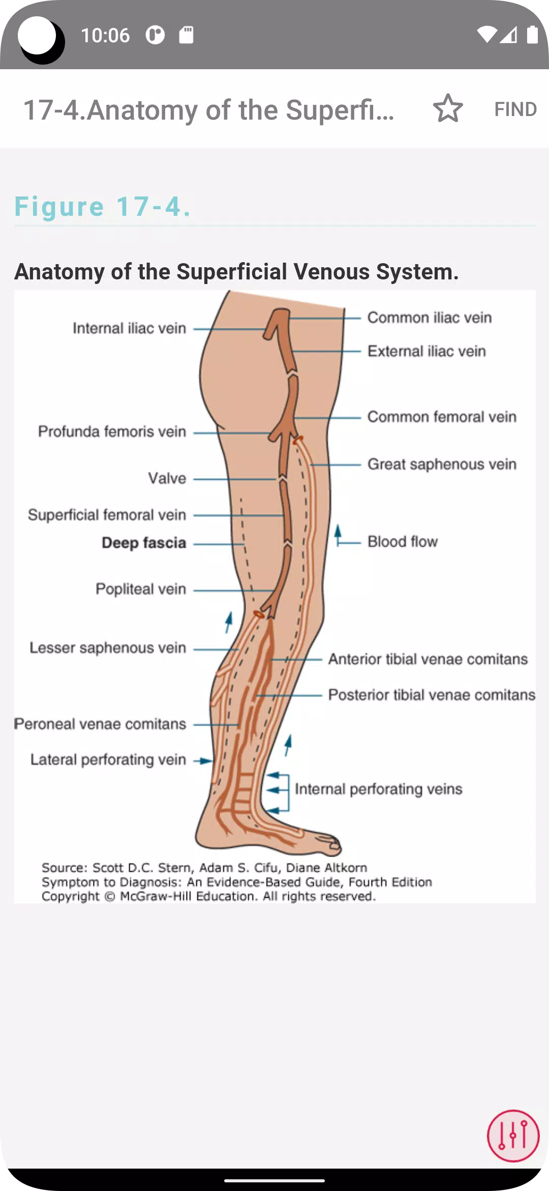Symptom to Diagnosis应用截图第2张