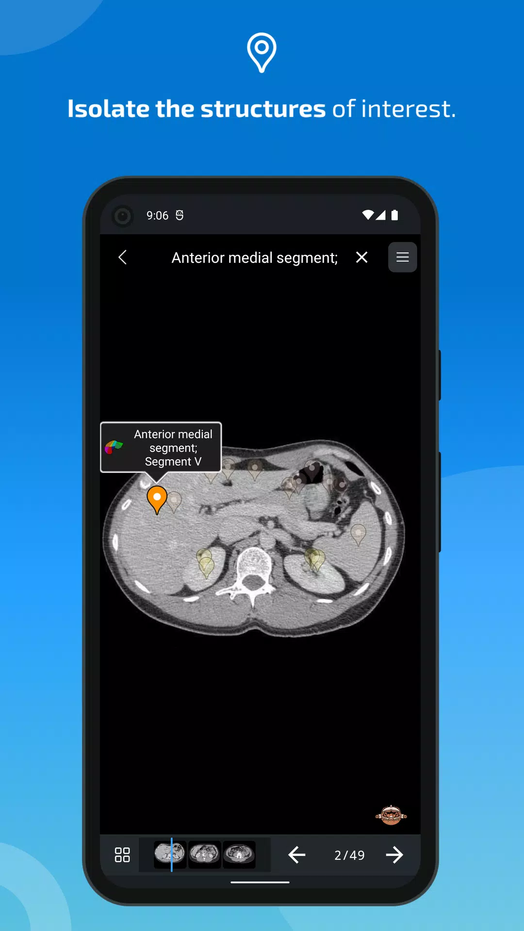 e-Anatomy 스크린샷 4