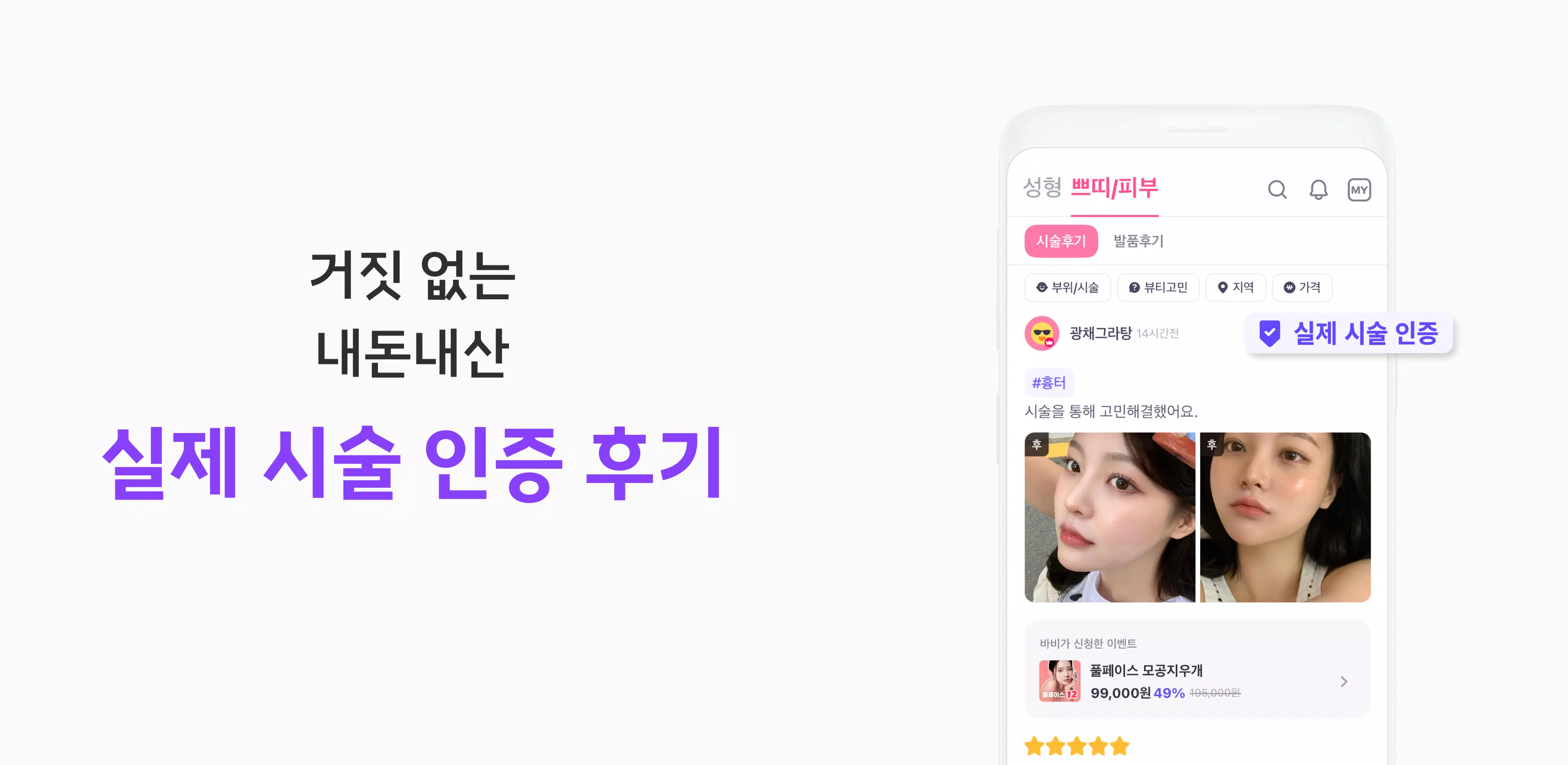 바비톡 - 성형 시술 성형외과 피부과 병원예약 성형어플 Screenshot 2